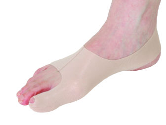 bunion aligner